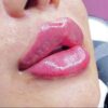تزریق بوتاکس و ژل وآموزش + مدرک