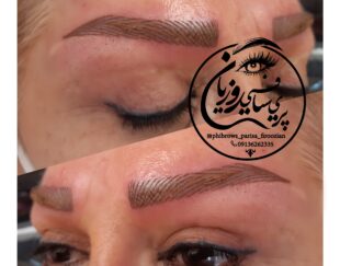 میکروبلیدینگ و میکروپیگمنتیشن