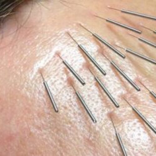 شروع ثبت نام در دوره های اموزشی_ تخصصی طب سنتی