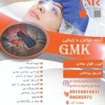 لیزر موهای زاید