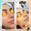 پاکسازی پوست با دستگاه روز دنیا