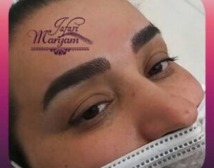 اموزش و خدمات میکروبلیدینگ