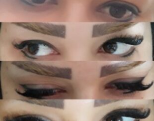 کاشت مژه هیدن