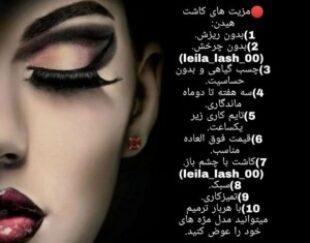 کاشت مژه