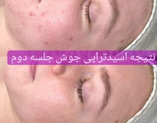 فیشیال/پاکسازی پوست
