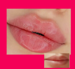 آموزش وخدمات ژل،بوتاکس،نخ،لیزر،کلینیک