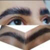اپلاسیون حرفه ای و تخصصی