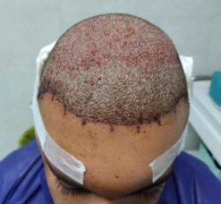 تخصصی ترین مرکز کاشت مو ابرو ریش وزیبایی