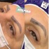 مدل برای آرایش دائم صورت در مرکز تخصصی