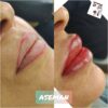 مدل برای آرایش دائم صورت در مرکز تخصصی