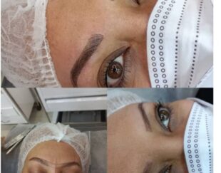 میکروبلیدینگ،فیبروز،هایپررئال