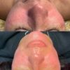 اموزش و خدمات پاکسازی پوست و تجهیزات پوست