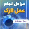 عمل لازک و لیزیک و prk