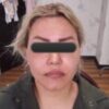 انجام خدمات زیبایی در مطب