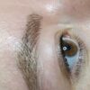 میکروبلیدینگ