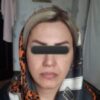 انجام خدمات زیبایی در مطب