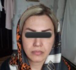 انجام خدمات زیبایی در مطب