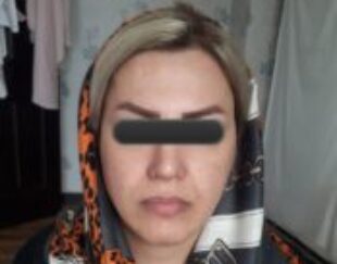 انجام خدمات زیبایی در مطب