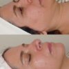 فیشال و پاکسازی پوست