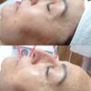 فیشال و پاکسازی پوست