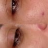 فیشال و پاکسازی پوست
