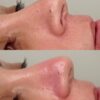فیشال و پاکسازی پوست