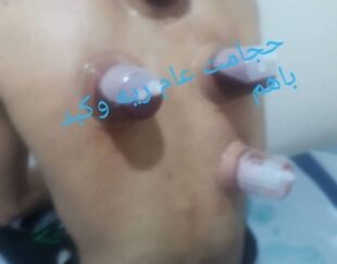 خدمات حجامت بادکش زالودرمانی
