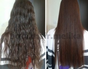 مدل بوتاکس و پروتئین تراپی مو