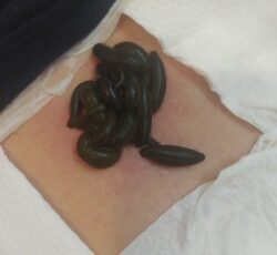 مرکز انواع حجامت تخصصی در اصفهان