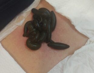 مرکز انواع حجامت تخصصی در اصفهان