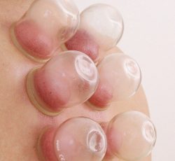 اموزش کلاس حجامت وفصدومزاج شناسی
