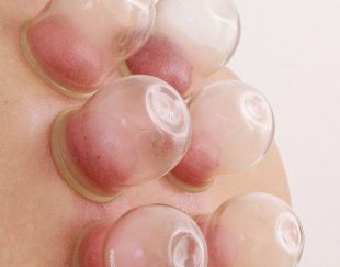 اموزش کلاس حجامت وفصدومزاج شناسی