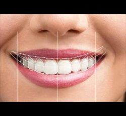 دندانسازی جایگزینی مناسب برای بی دندانی