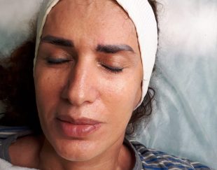 کلینیک زیبایی و لیزر لوتس