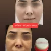 کرم ضد لک و سفید کننده دائمی