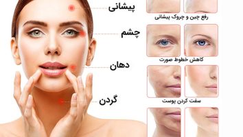 دستگاه مینی هایفو خانگی لیفت پوست و لیفتینگ صورت
