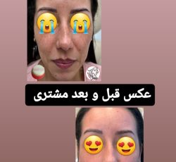 ضد لک عروس