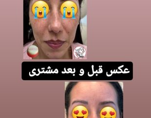 ضد لک عروس