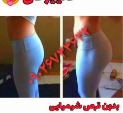 حجم دهی و فرم دهی سینه و باسن
